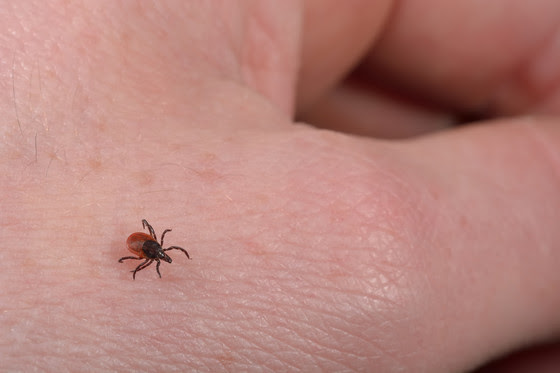 Lyme Disease Awareness Month: Protect yourself from tick bites